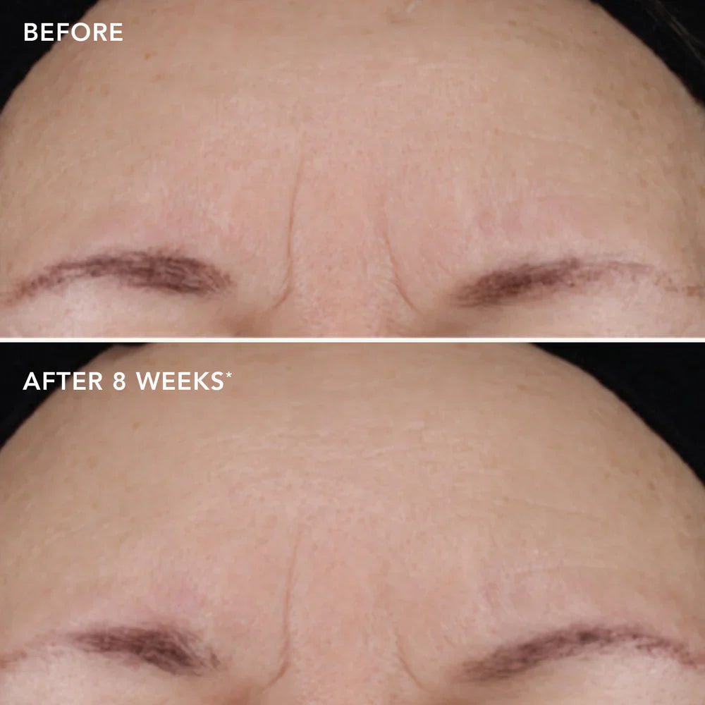 AGELESS+ retinol treatment crème 1.2%