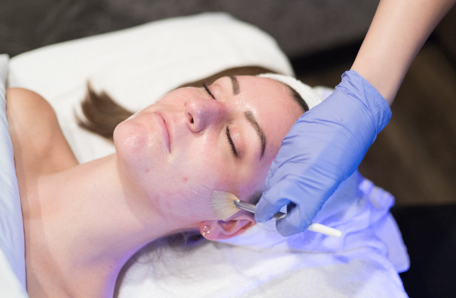 Fall Skincare: Unlocking the Beauty Benefits of Custom Peels