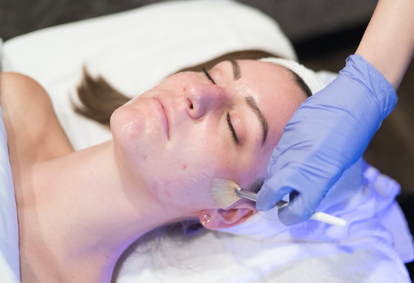 Kicking Off Peel Season: Introducing Skinbetter Alpharet Professional Peel