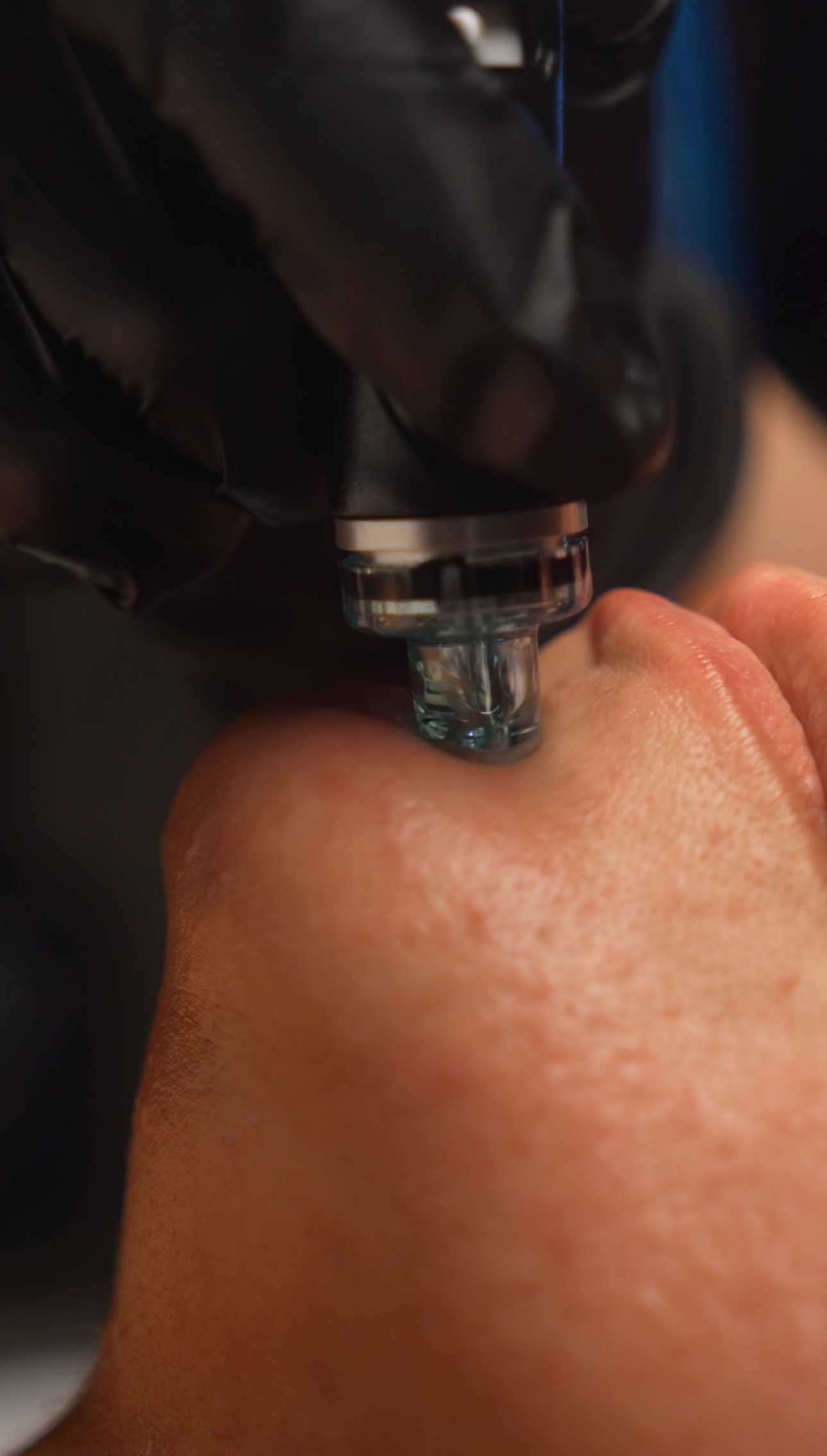 Winter Skin SOS: How to Keep Your Glow When the Weather Turns Cold