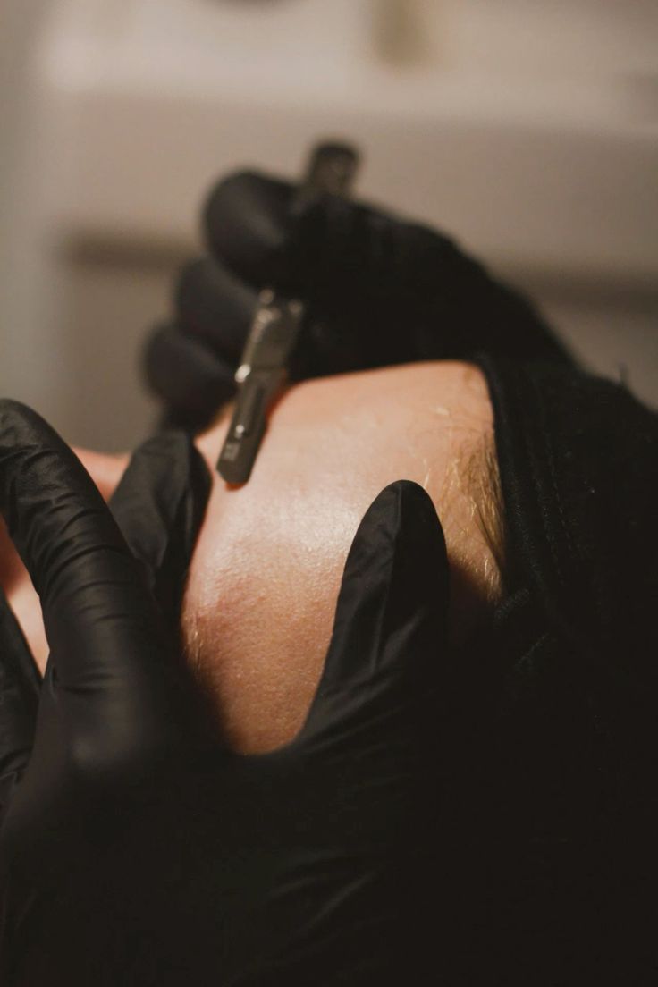Dermaplaning Dos and Don'ts