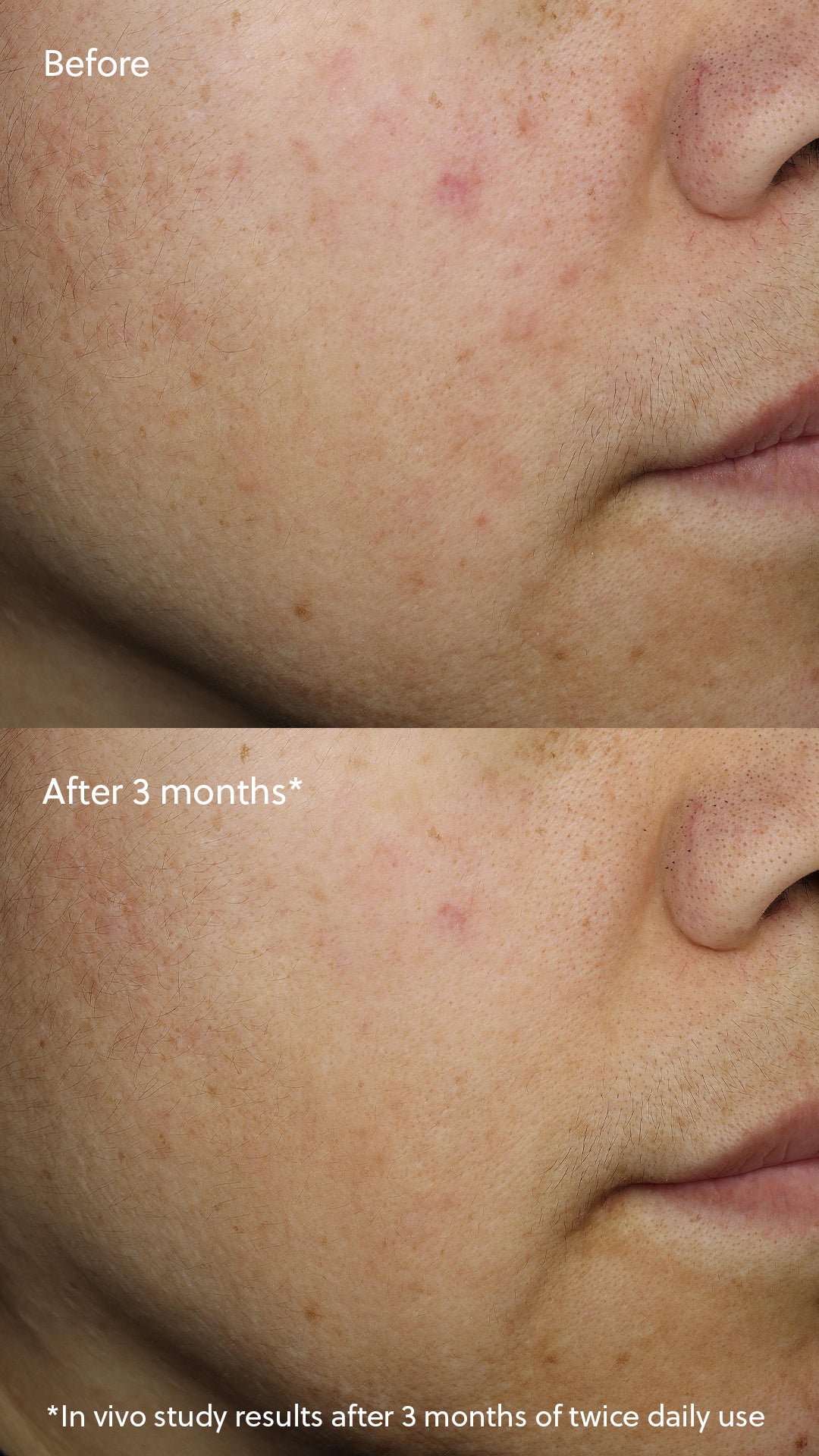 Vitamin C⁺ Serum