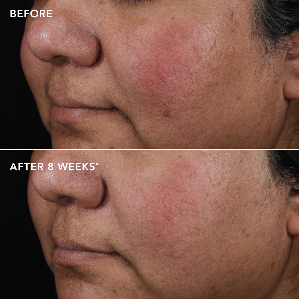 AGELESS+ retinol pure liquid retinol 0.75%