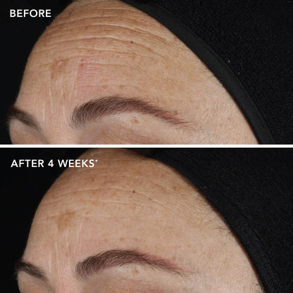 AGELESS+ retinol pure liquid retinol 0.1%